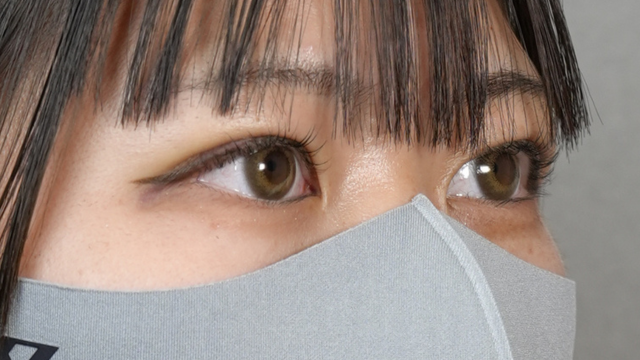 Postoperative Condition Part 1