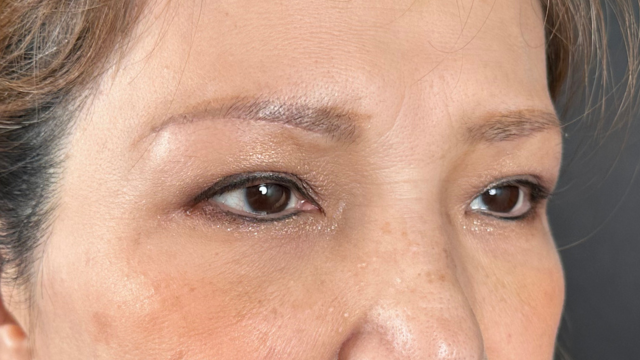 Postoperative Condition Part 1