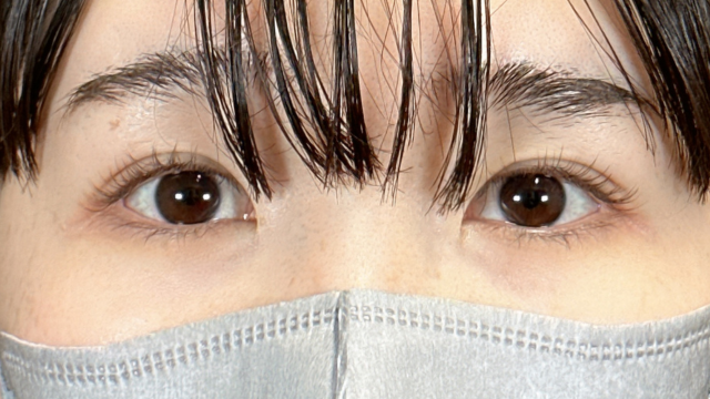 Postoperative Condition Part 1