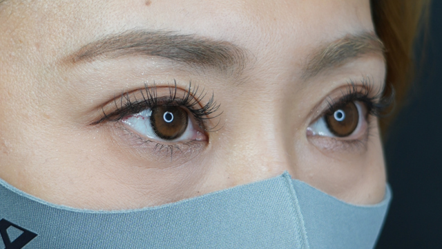 Postoperative Condition Part 1