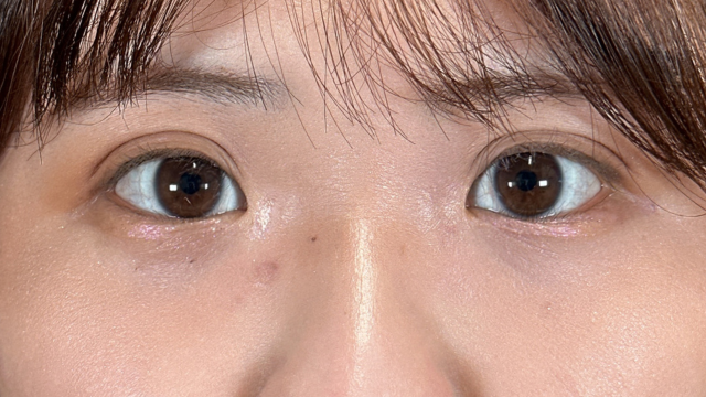 Postoperative Condition Part 1