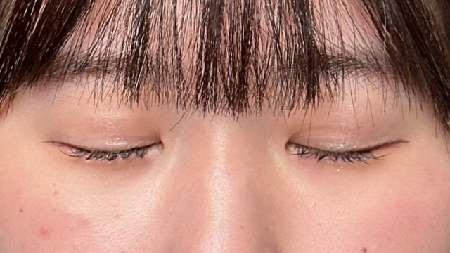 Postoperative Condition Part 1