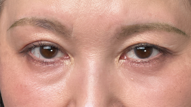 Postoperative Condition Part 1