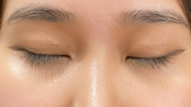 Postoperative Condition Part 1