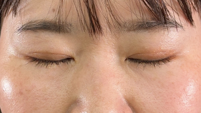 Postoperative Condition Part 1