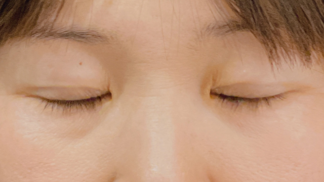 Postoperative Condition Part 1