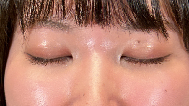 Postoperative Condition Part 1