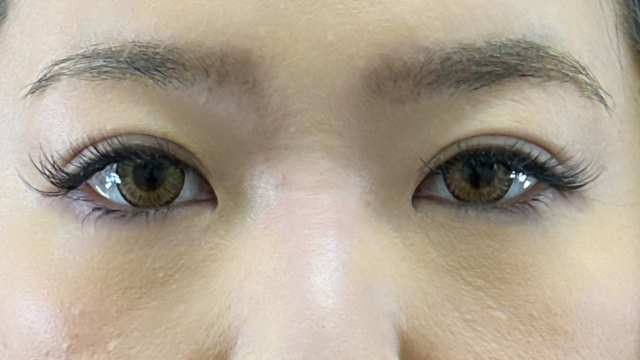 Postoperative Condition Part 1