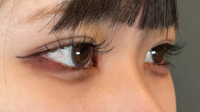 Postoperative Condition Part 1