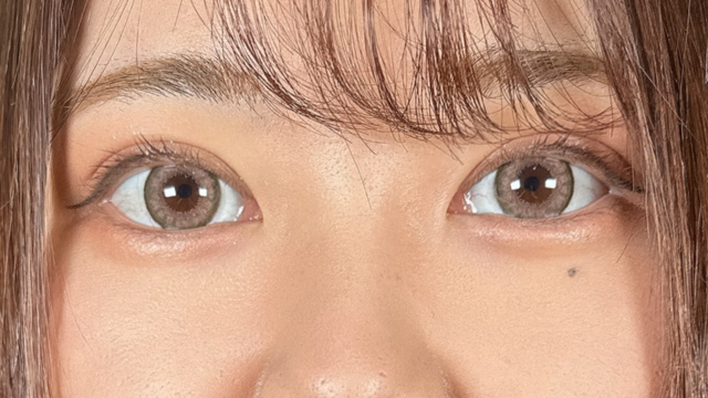 Postoperative Condition Part 1