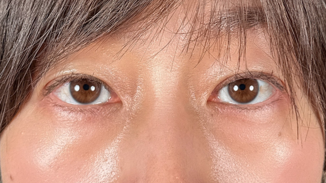 Postoperative Condition Part 1