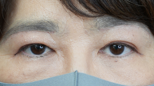 Postoperative Condition Part 1