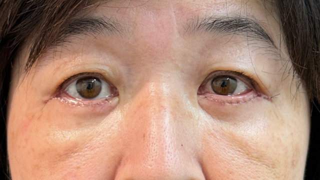 Postoperative Condition Part 1