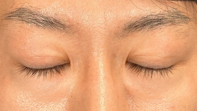 Postoperative Condition Part 1