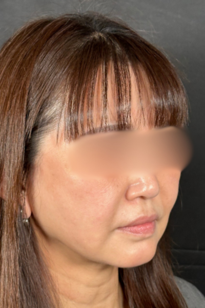 Postoperative Condition Part 1