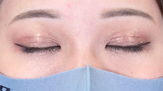 Postoperative Condition Part 1