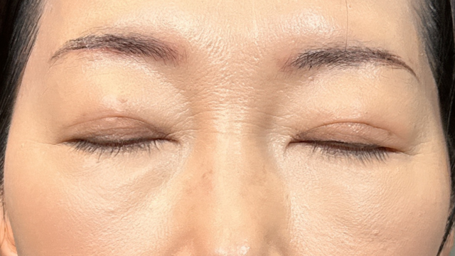 Postoperative Condition Part 1