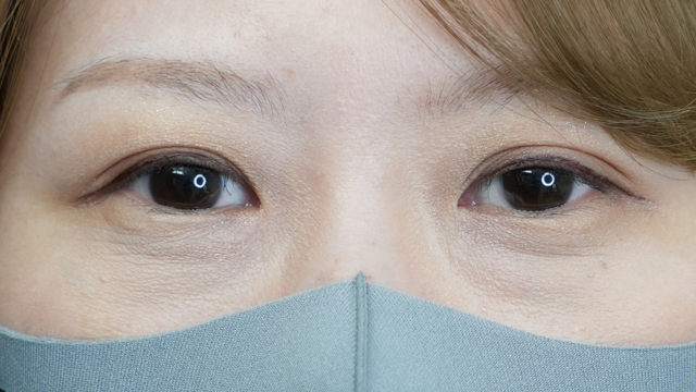 Postoperative Condition Part 1