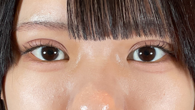 Postoperative Condition Part 1