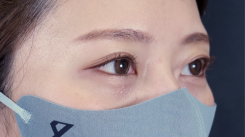 Postoperative Condition Part 1