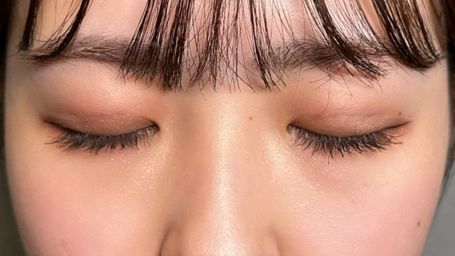 Postoperative Condition Part 1