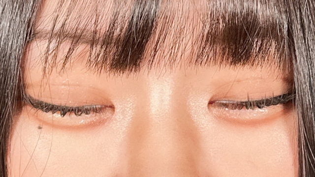 Postoperative Condition Part 1