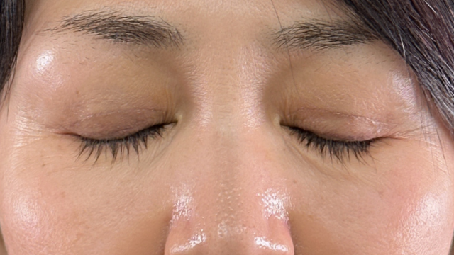 Postoperative Condition Part 1