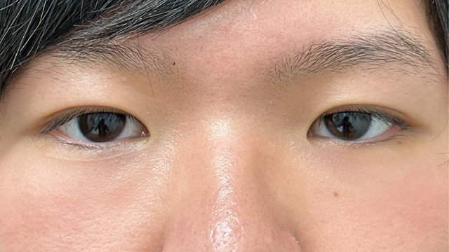 Postoperative Condition Part 1