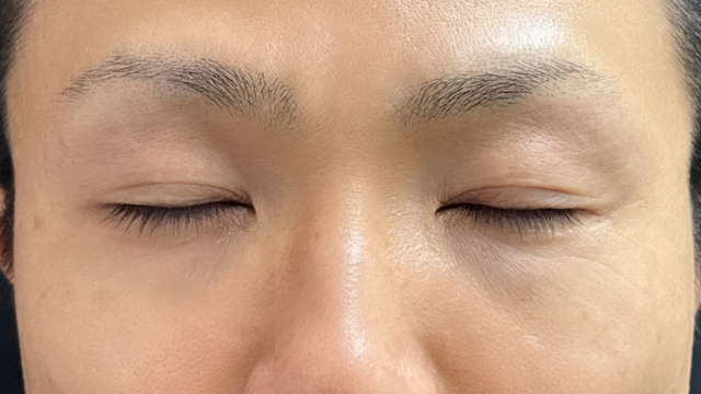 Postoperative Condition Part 1