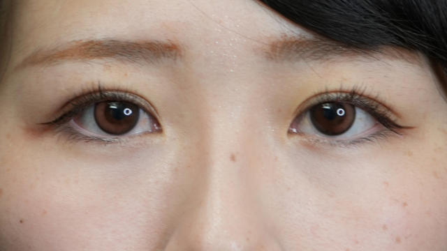 Postoperative Condition Part 1