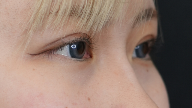 Postoperative Condition Part 1