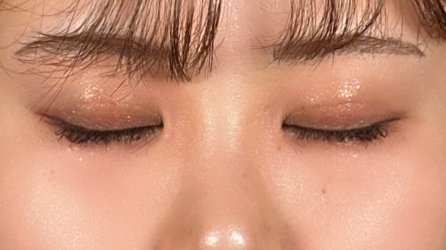 Postoperative Condition Part 1