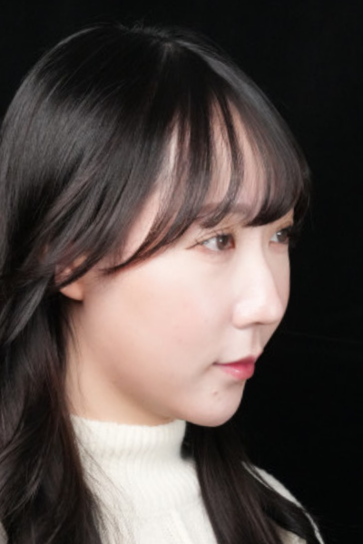 手術後の状態 その1