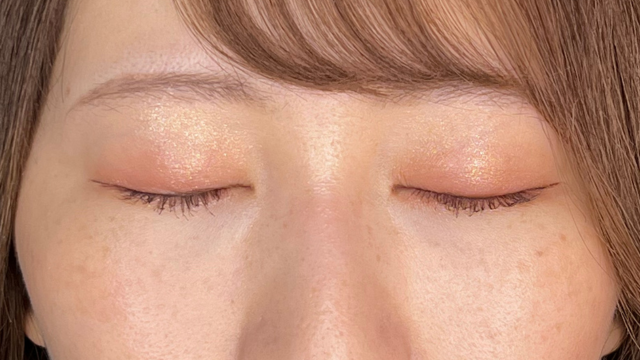 Postoperative Condition Part 1