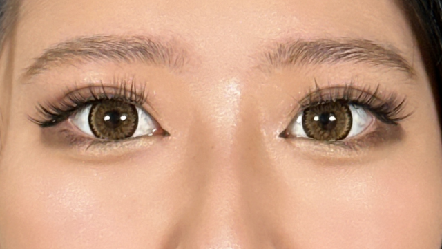 Postoperative Condition Part 1