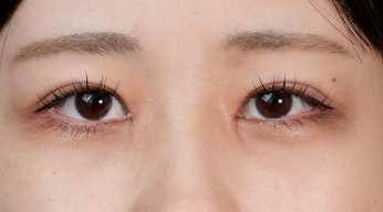 Postoperative Condition Part 1