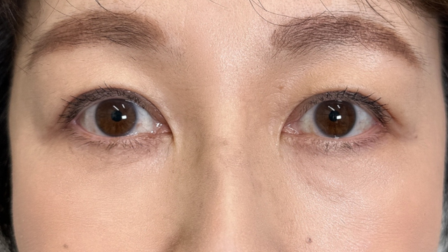 Postoperative Condition Part 1