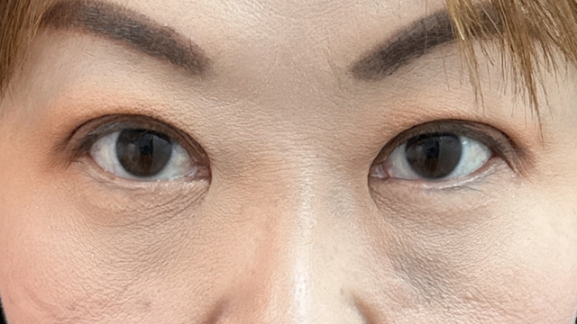 Postoperative Condition Part 1