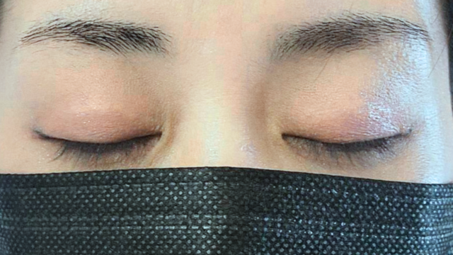 Postoperative Condition Part 1