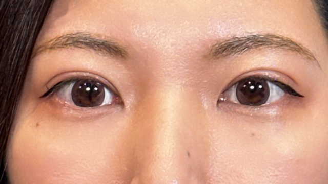 Postoperative Condition Part 1