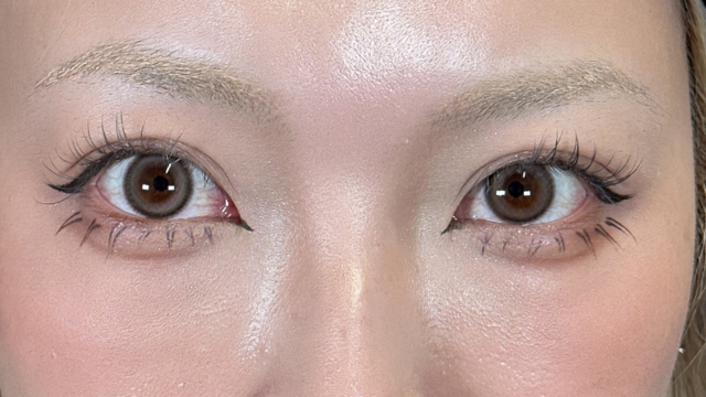 Postoperative Condition Part 1