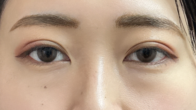 Postoperative Condition Part 1