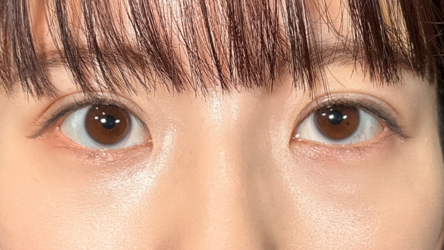 Postoperative Condition Part 1