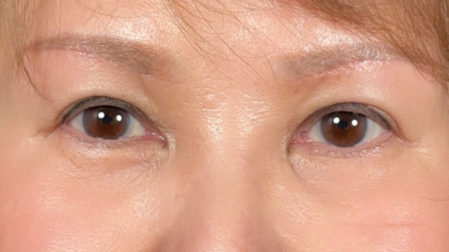 Postoperative Condition Part 1