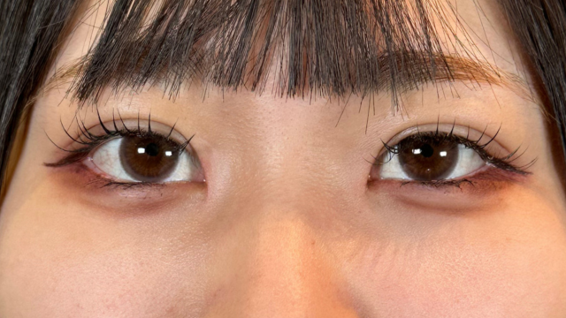 Postoperative Condition Part 1