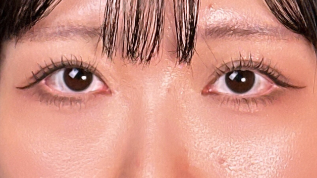 Postoperative Condition Part 1