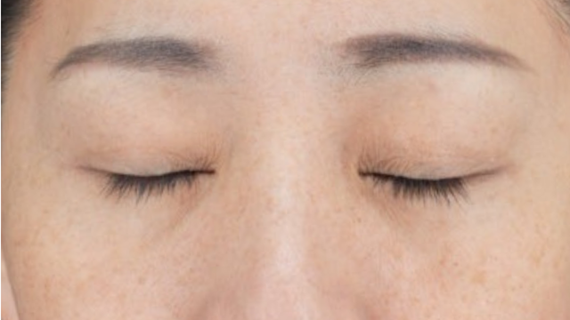 Postoperative Condition Part 1