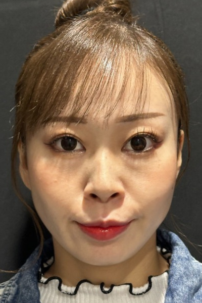 手術後の状態 その1