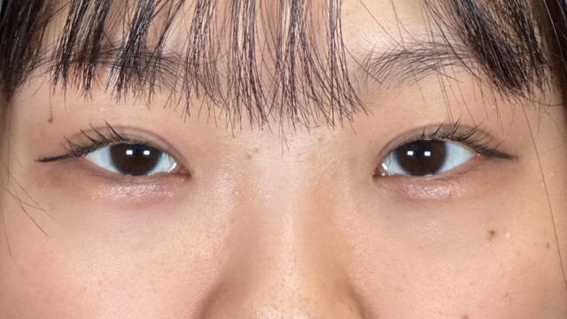 Postoperative Condition Part 1