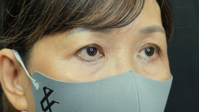 Postoperative Condition Part 1